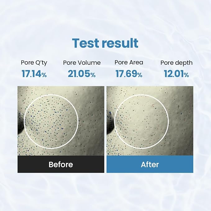 Peeling Toner Pad – 60 Pads – Blackhead & Whitehead Removal, Pore Minimizing, Oil Control, Gentle PHA Exfoliation for Sensitive Skin