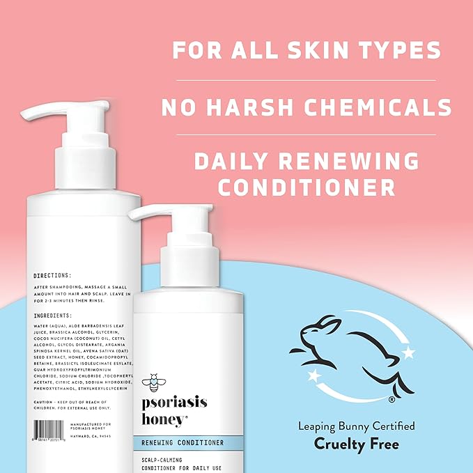 Renewing Conditioner - Dry Scalp Treatment - Psoriasis Cream for Dry Hair - Coconut Oil Hair Moisturizer Helps Relieve Symptoms of Eczema, Dandruff, Dermatitis & More (8oz)