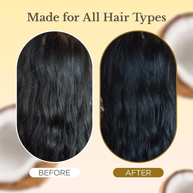 Natural Coconut Oil Hydrating Shampoo (400ml) | Chemical Free Moisturizing Dandruff Formula for Dry, Damaged, Hair & Scalp | Safe on Color Treated Hair | Professional Salon Quality