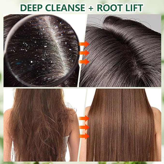 Scalp Scrub with Rosemary & Mint, 2-in-1 Exfoliating Shampoo for Hair Treatment, Includes Silicone Scalp Massager, Removes Buildup & Dandruff, 10.6oz