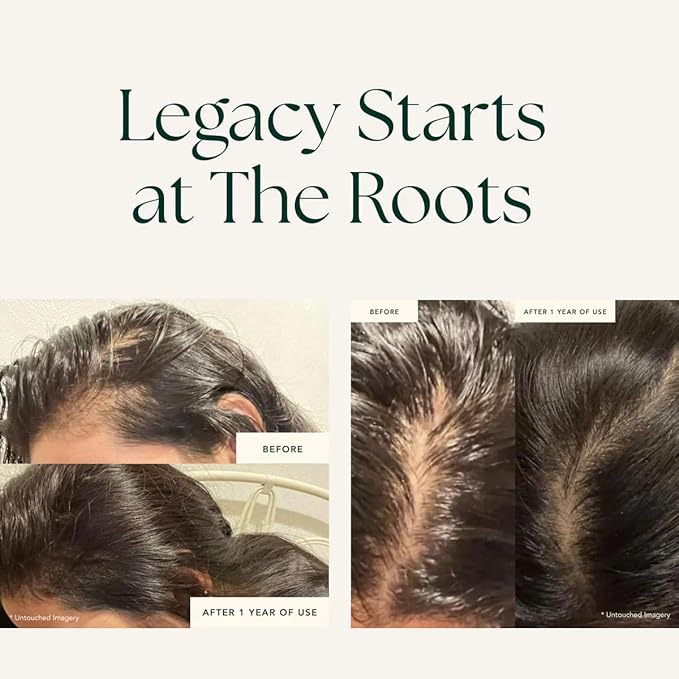 RANAVAT Mighty Majesty Travel Size Hair Serum - Fortifying Hair Oil Serum for Scalp Hydration, Frizz Control, & Hair Shine - With Jasmine and Amla Extract (0.5 oz)