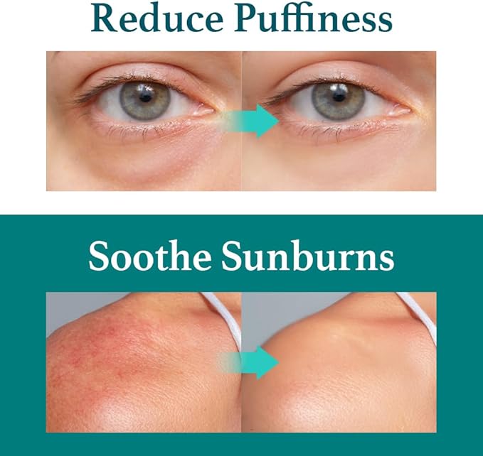 Ice Sorbet Toner Pads | Skin Prep Wipes for Puffiness, Under Eye Bags & Instant Face Lift | Gel Pads for Sunburn Relief & After Sun with 30% Glacier Water & Caffeine | Pack of 4 (240 Count)