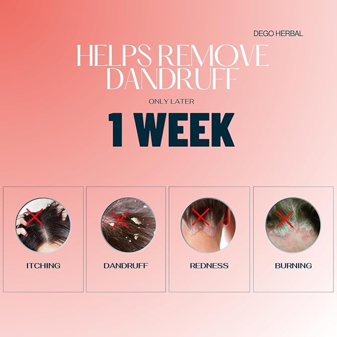 Deep Refresh Zizyphus Scalp Care Shampoo – Gentle Cleanse for Healthy-Looking Hair 2.7 Fl Oz. Natural extract from tree bark