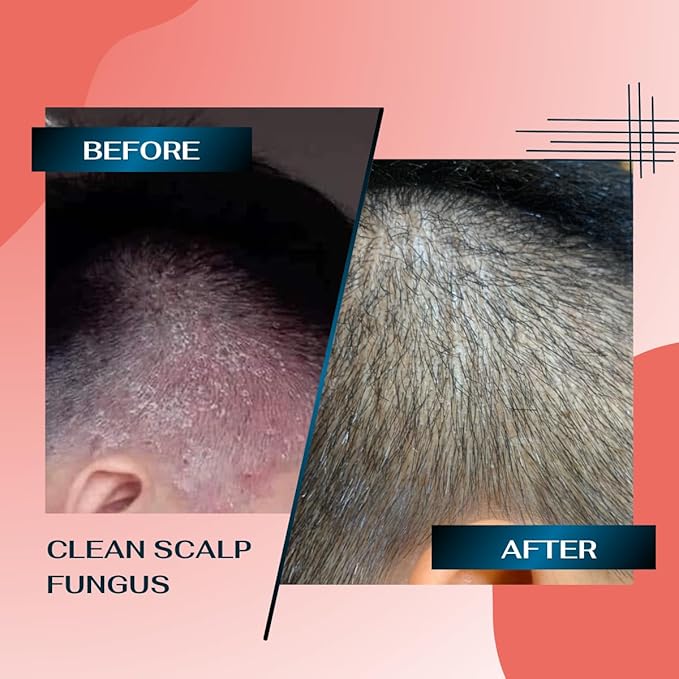 Deep Refresh Zizyphus Scalp Care Shampoo – Gentle Cleanse for Healthy-Looking Hair 2.7 Fl Oz. Natural extract from tree bark