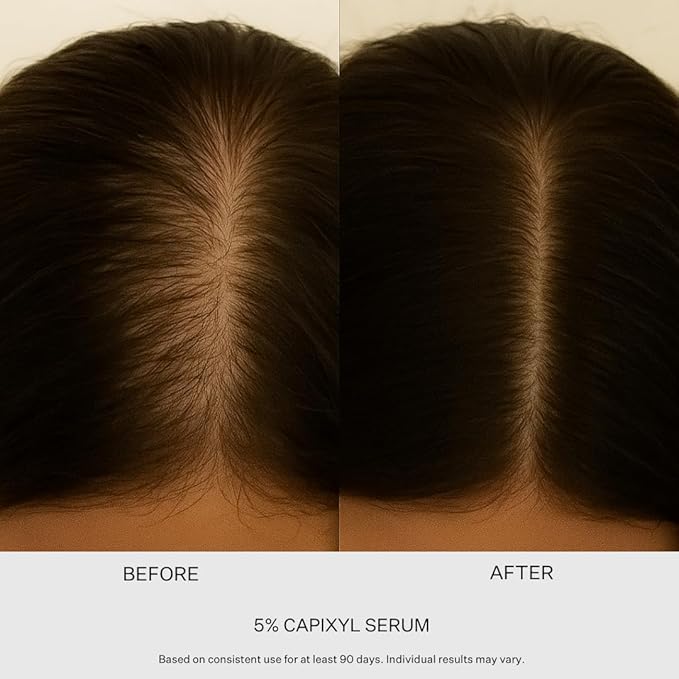 5% Redensyl Hair Growth Serum - Vegan Follicle Activator & Hair Thickening Serum for Men & Women's Hair Growth. Scalp & Hair Density Serum for Thicker, Fuller Hair Care