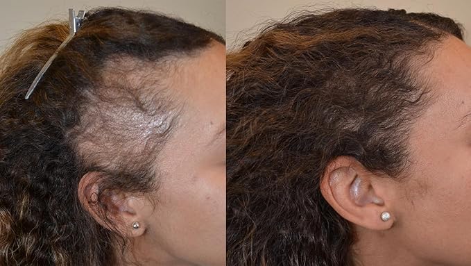 Hair Growth Mixture, Fast Track Hair Oil (34 in 1) for rapid growth, Moisturizer, restore scalp, blend of exotic oils and rare botanical extracts. For all hair types. 2 fl oz