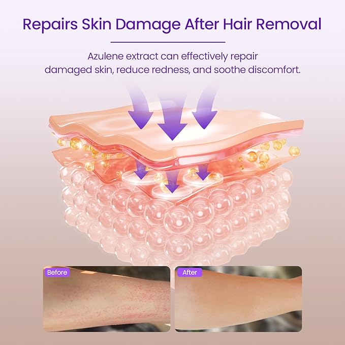 Aloe Vera Gel Soothes Skin for After IPL Laser Hair Removal Women Men in Face or Body, Travel Aloe Vera Gel for Sunburn Relief, Hydrate and Moisturize, Chamomile Extracts, 4.1 fl oz