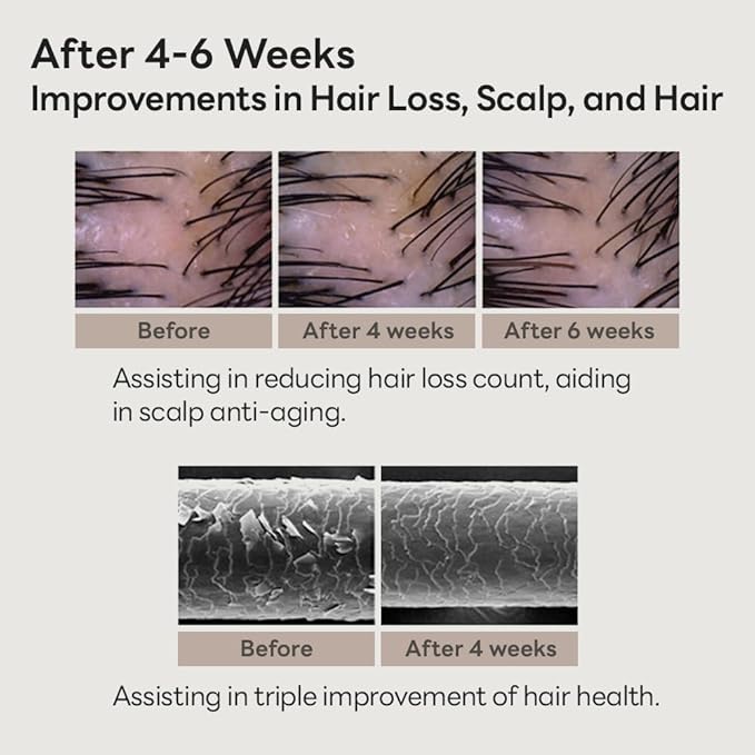 Scalp Intensive Shampoo with Biotin | Korean Shampoo for Hair Loss, Hair Regrowth, Thinning Hair, Volume Boost & Damage Repair (13.52 fl oz)