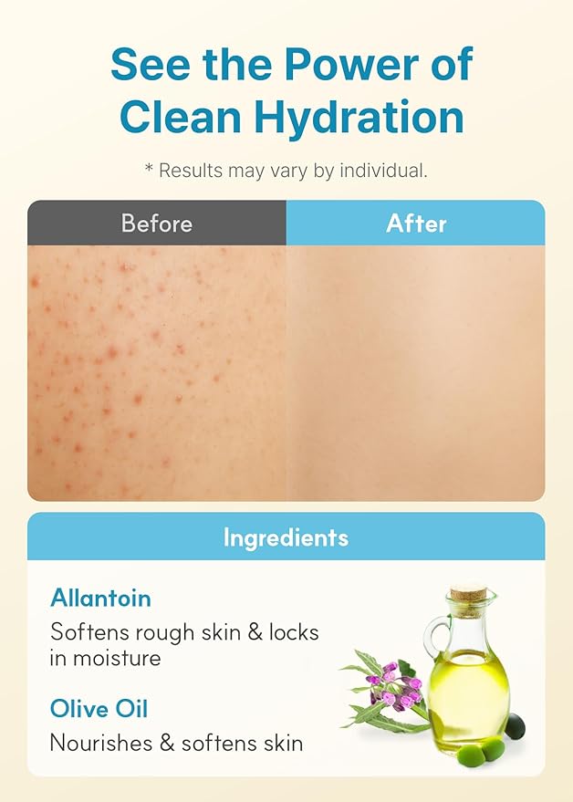 Derma B | Daily Moisture Body Lotion | Body Cream for Dry Skin | Long-Lasting Body Moisturizer for Sensitive Skin | Woody & Powdery Scented | Skincare with Panthenol, Shea Butter | 13.5 fl oz (400ml)