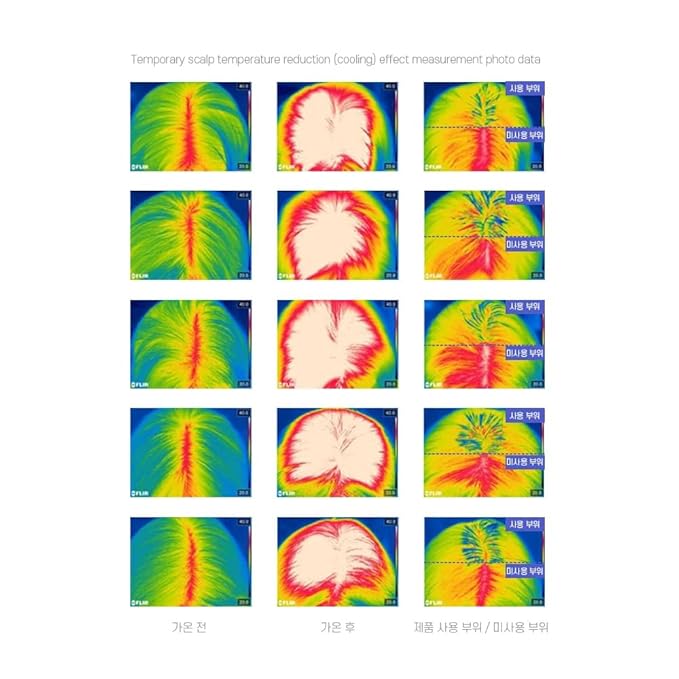 TS New TS Cool Shampoo | Cooling Korean Shampoo with Mint & Tea Tree Oil | Hair Loss Care with Dexpanthenol, Salicylic Acid | Suitable for Oily Scalp (17.6 Fl Oz)