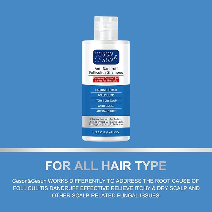 Ceson&Cesun Anti-Fungal/Anti Dandruff 2 in 1 Shampoo for Folliculitis, Scalp Psoriasis & Seborrheic Dermatitis, Itchy & Dry Scalp Relief, Nourishes, Hydrates, Fresh Scent, Safe For Color-Treated Hair
