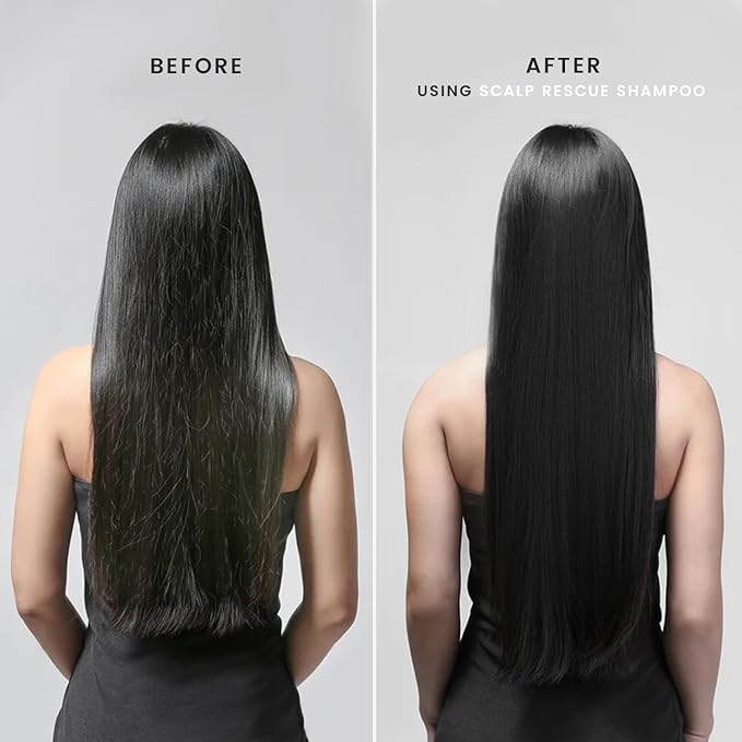 MGA Vegan Hair Shampoo - Organic Formula With Lemon Tea Tree for All Hair Types | Hair Care Product with Natural Herbal Scent | Parabens Silicone & Sulfate Free Dandruff Shampoo | Unisex | 32 Fl Oz