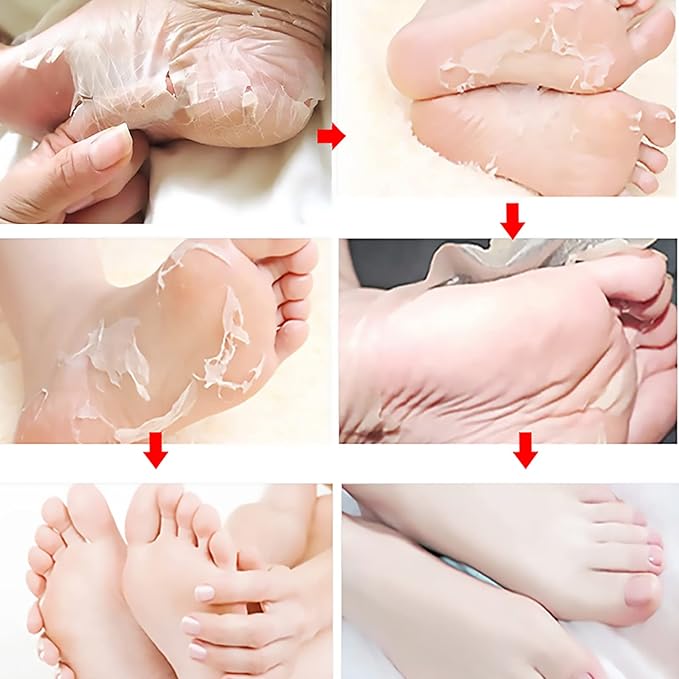 Exfoliating Foot Mask with AHA 30% + BHA 2%, Natural Moisturizing Peeling Solution for Dry Cracked Feet, 1 Pair
