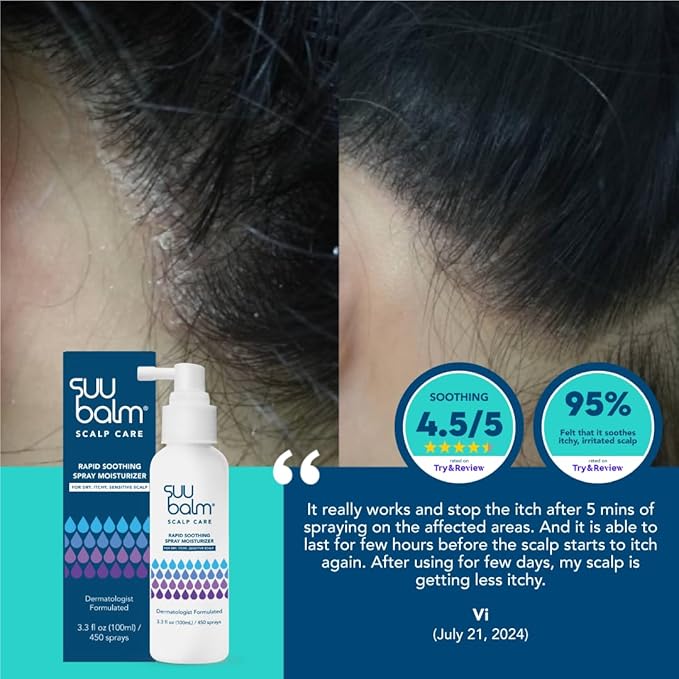 Rapid Itch Relief Anti-Dandruff Scalp Spray Moisturizer, Dry Scalp Spray, Cooling Itchy Scalp Treatment for Flaky Sensitive & Psoriasis, Derm-Formulated. Menthol & 5 Ceramides, 3.38 fl oz