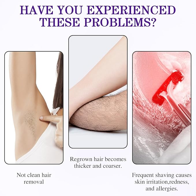 Cyperglow - Cyperus Rotundus Skin Serum, Natural Organic Cyperus Rotundus Oil, Lightweight Soothing Body Oil, Natural Soothing and Gentle (2PC)