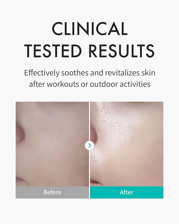 REJURAN® Skin Protection Mask, c-PDRN® – Hydrating and Soothing Facial Sheet Mask for Irritated, Stressed, Repairs & Restores Skin Barrier with Panthenol & Allantoin, Korean Skin Care. 5-Pack