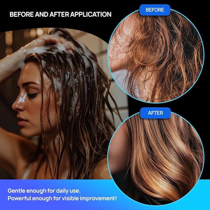 Castor Oil Shampoo and Conditioner Set; Dry Scalp Dandruff Treatment; Organic, Sulfate Free, Moisturizing Shampoo and Conditioner Set for Hair Care and Repair; Made in USA, 10 oz Bottles