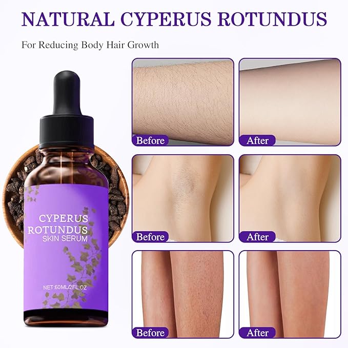 Cyperglow - Cyperus Rotundus Skin Serum, Natural Organic Cyperus Rotundus Oil, Lightweight Soothing Body Oil, Natural Soothing and Gentle (1 PC)
