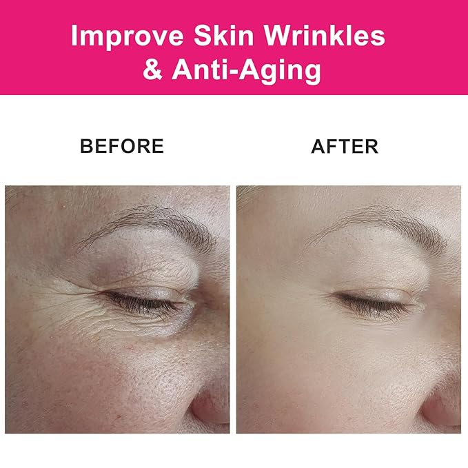 Organic Rosehip Seed Oil for Face, USDA Certified, Cold Pressed, Unrefined, 100% Pure Natural Rose Hip Oil (1oz / 30ml) for Anti-Aging, Acne Scar Treatment, Skin & Hair Care, Gua Sha Massage