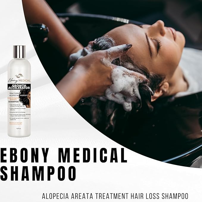 Ebony Medical Alopecia Areata Treatment Shampoo – Hair Loss & Thinning Hair Support – Stimulates Hair Growth & Scalp Health – Receding Hairline & Bald Spot Solution – 12 fl oz – Natural & Vegan