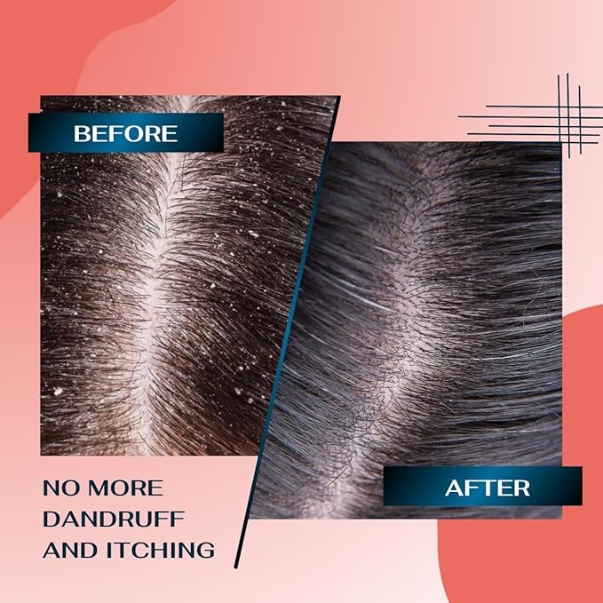 Deep Refresh Zizyphus Scalp Care Shampoo – Gentle Cleanse for Healthy-Looking Hair 2.7 Fl Oz. Natural extract from tree bark