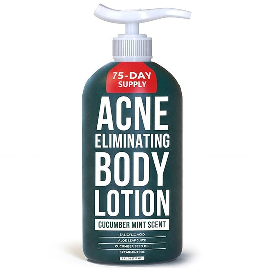 TreeActiv Acne Eliminating Body Lotion 8 fl oz | Clears Body, Back, Butt and Shoulder Acne | Anti-Acne Moisturizer | Prevents Future Breakouts | Cucumber Mint Scent