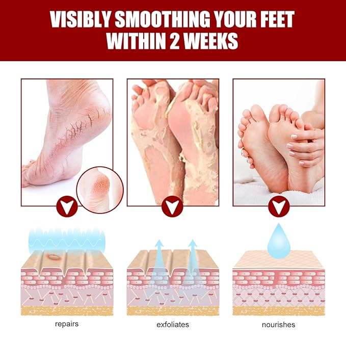 Exfoliating Foot Mask with AHA 30% + BHA 2%, Natural Moisturizing Peeling Solution for Dry Cracked Feet, 1 Pair