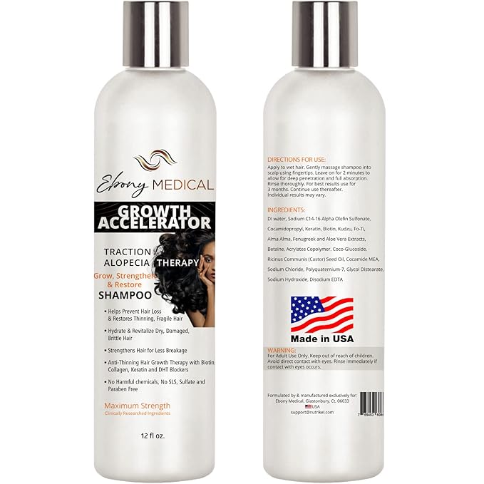 Ebony Medical Alopecia Areata Treatment Shampoo – Hair Loss & Thinning Hair Support – Stimulates Hair Growth & Scalp Health – Receding Hairline & Bald Spot Solution – 12 fl oz – Natural & Vegan