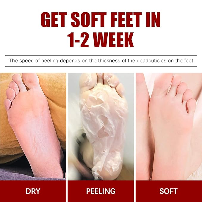 Exfoliating Foot Mask with AHA 30% + BHA 2%, Natural Moisturizing Peeling Solution for Dry Cracked Feet, 1 Pair