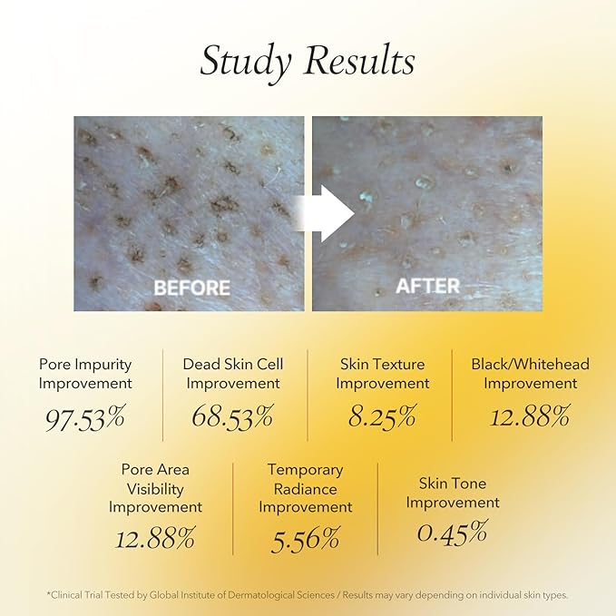 APRILSKIN Pore care & Glow Booster duo: Calendula Flower-Infused Facial Peel Off Mask, Carrotene IPMP 3-Min Quick Dry Pore Caring Clay Mask & Face Mask Applicator Jelly Brush