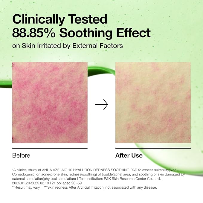 Anua Azelaic 10 Hyaluron Redness Soothing Pad, Troubled & Spot Care with Korean toner pads, Quick & Easy Stretchable Facial Mask with Azelaic acid, Hyaluronic Acid, Korean Skin Care (90 pads)