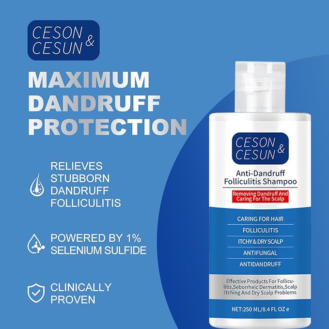 Ceson&Cesun Anti-Fungal/Anti Dandruff 2 in 1 Shampoo for Folliculitis, Scalp Psoriasis & Seborrheic Dermatitis, Itchy & Dry Scalp Relief, Nourishes, Hydrates, Fresh Scent, Safe For Color-Treated Hair