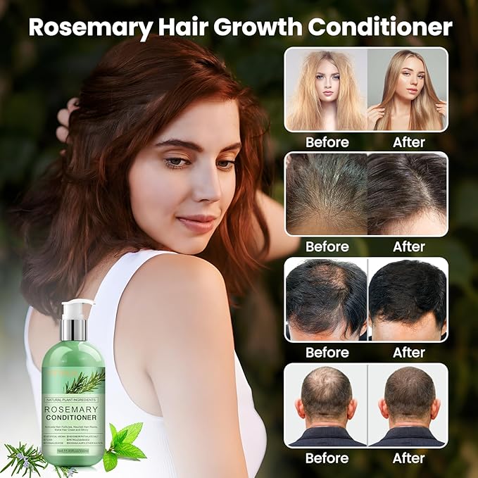 Rosemary Conditioner for Hair Growth: Thinning Hair & Anti-Hair Loss Treatment for Men and Women - Rosemary Mint Strengthening Conditioner with Tea Tree Oil Biotin