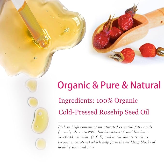 Organic Rosehip Seed Oil for Face, USDA Certified, Cold Pressed, Unrefined, 100% Pure Natural Rose Hip Oil (1oz / 30ml) for Anti-Aging, Acne Scar Treatment, Skin & Hair Care, Gua Sha Massage