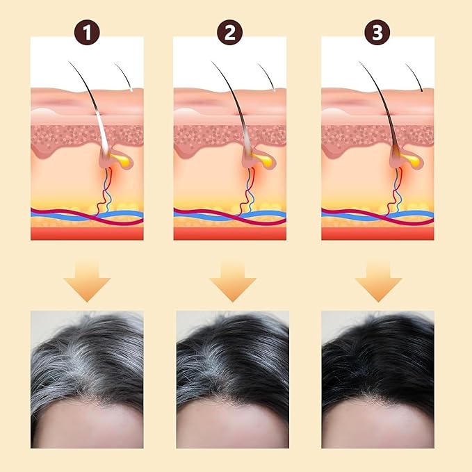 Root activating shampoo, hair growth soap, deep cleansing scalp, natural formula, with moisturizing and scalp care effects, suitable for men and women to use