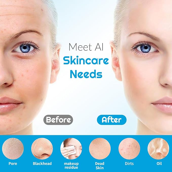 Landmore Silicone Face Scrubber, Waterproof Facial Cleansing Brush with Red Light Thermal Massage, Electric Face Scrubber with Nose Scrubber Exfoliator for Women/Men Deep Cleansing, Power Exfoliating