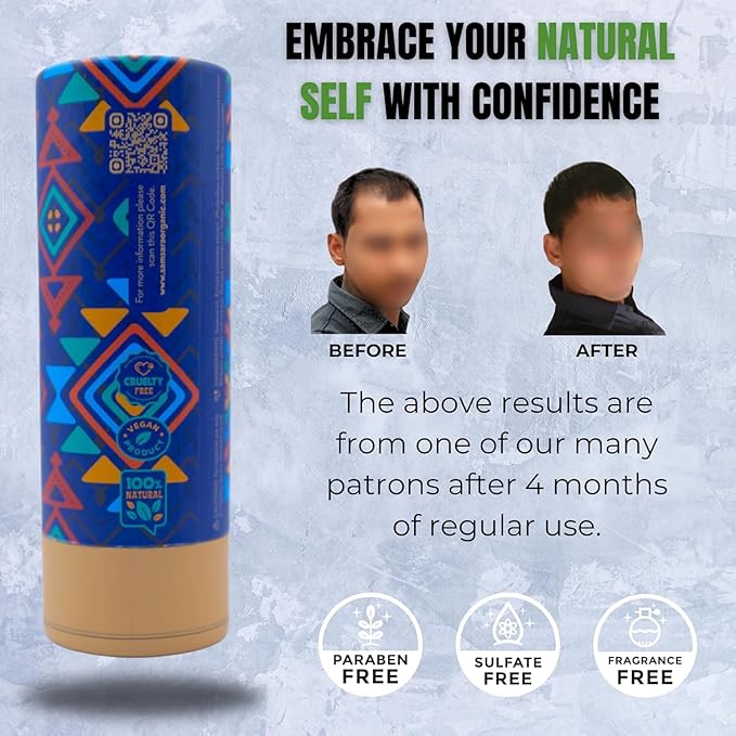 Herbal Scalp Oil | Nourishes Hair, Hydrates Scalp | Reduces Dandruff & Greying | Boosts Growth & Shine | Natural Hair Care for Men & Women | 100ml