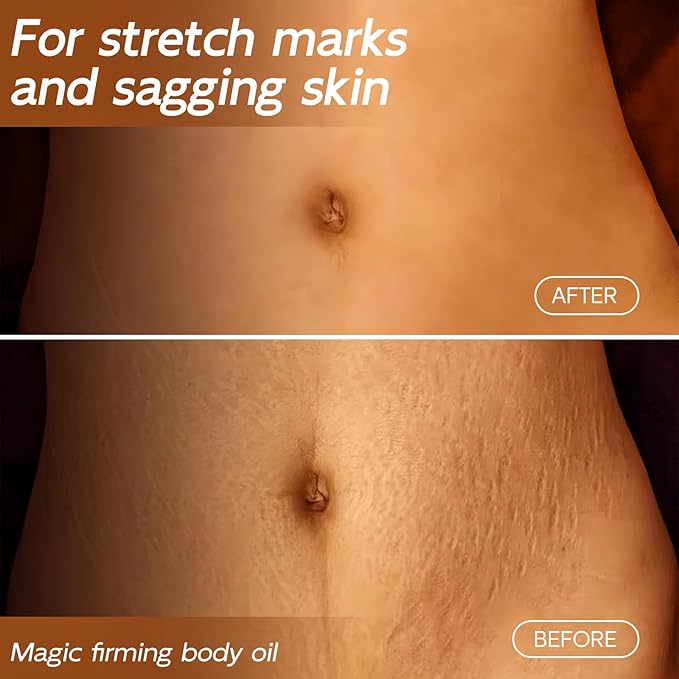 Beaque Magic Body Firming Oil, 3.38 FL OZ, Korean Skin Care Post-Shower Body Oil for Women – With Jojoba Oil,to Tighten, Hydrate & Nourish Dry Skin, Lightweight & Non-Greasy for Full Body Use