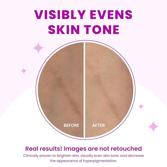 Lume Acidified Body Wash - 24 Hour Odor Control - Removes Odor Better than Soap - Moisturizing Formula - Formulated Without SLS or Parabens - OB/GYN Developed - 8.5 ounce (Unscented)