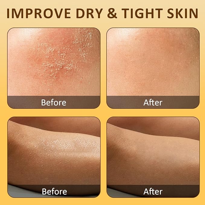 Beef Tallow, Beef Tallow for Skin, Tallow Face Moisturizer, Honey-Flavoured Whipped Tallow Face Cream Moisturizer Beef Tallow Blam Grass Fed Body Lotion Skin Care, 5.3 OZ