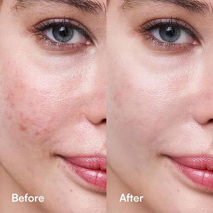 C Berry Oil Serum with Vitamin C, Sea Buckthorn, Rosehip, Jojoba, Squalane - Reduces Hyperpigmentation, Age Spots, Scars, Fine Lines - Nail and Cuticle Treatment - Glowing Skin, 1 fl. oz