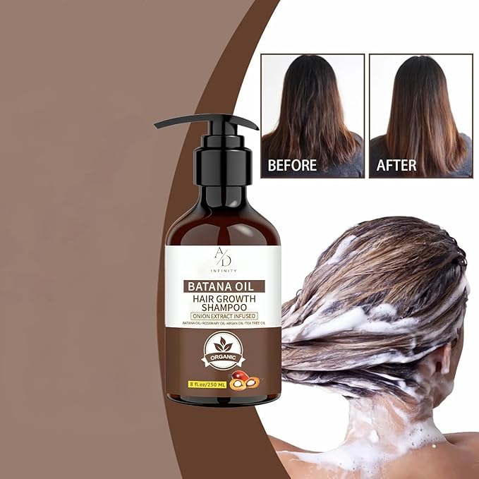 Batana Oil Hair Growth Shampoo – Onion Extract Infused, Organic Natural Formula with Rosemary & Argan Oil – Reduces Hair Loss, Strengthens Roots & Adds Shine for All Hair Types