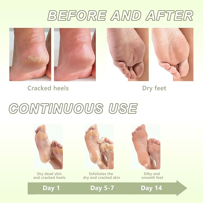Foot Peeling Mask, Cucumber Exfoliating Feet Peel Mask, Remove Dead Skin Callus Repair Heels, Foot Moisturizing, Foot Mask For Cracked Feet (3PAIRS)