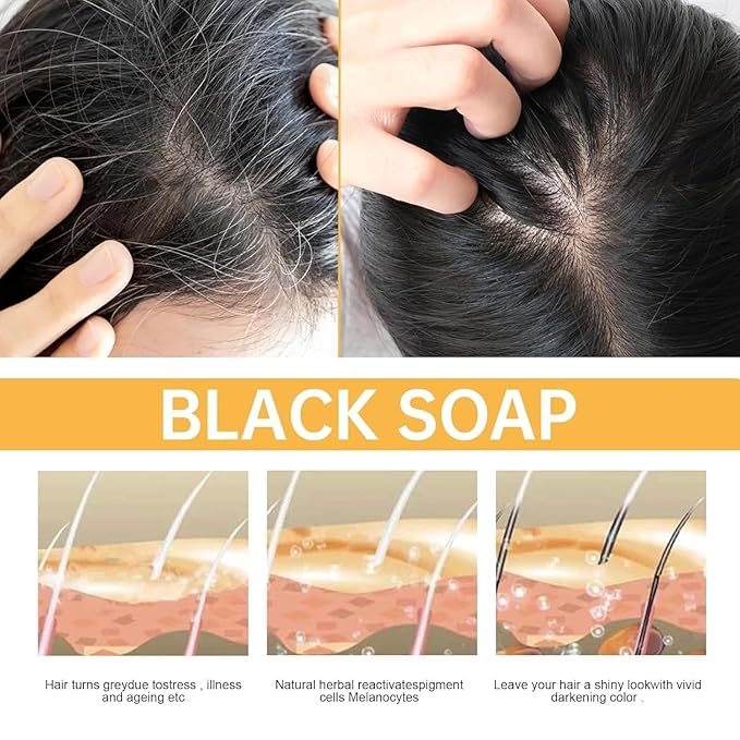 Root activating shampoo, hair growth soap, deep cleansing scalp, natural formula, with moisturizing and scalp care effects, suitable for men and women to use