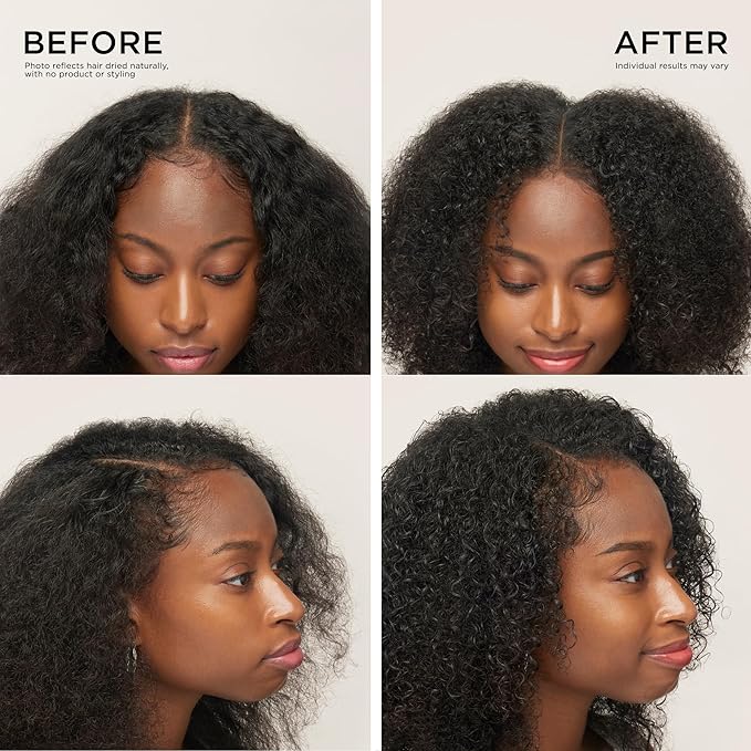 Dr. Groot Award-Winning Hair Thickening Serum for Hair Loss, Thinning Hair, Korean Hair Care, Scalp Treatment, Clinically Tested, Thicker Hair, Reduces Oil, Roll On