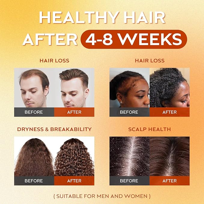 Raw Batana Oil for Hair Growth Dr Sebi, 100% Pure Organic Batana Hair Mask from Honduras, Wild Growth Hair Oil, Scalp Oil Promotes Hair Thickness, Prevents Loss for Men & Women, 4.06 fl oz (1 Pack)