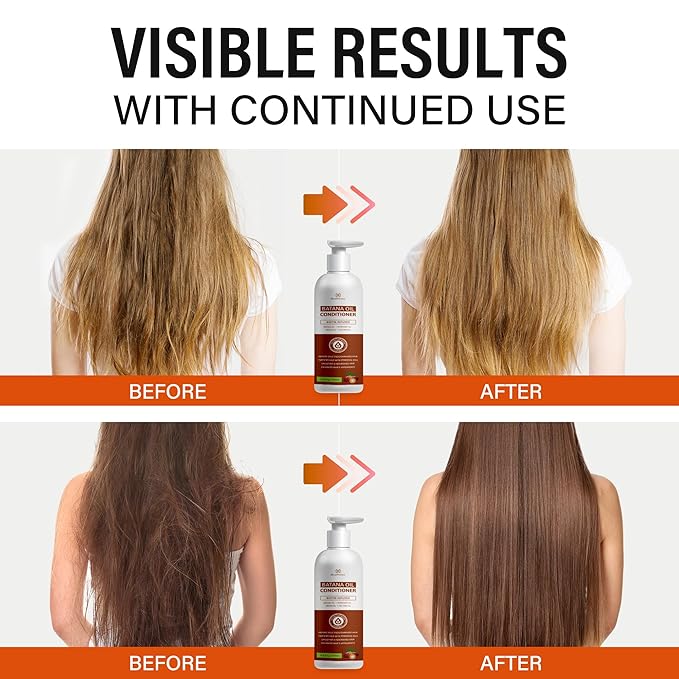 Batana Oil Hair Growth Conditioner: Natural Hair Thickening Moisturizing Product for Thinning Hair for Women and Men - Daily Hair Care at Home - 11.8 fl.oz