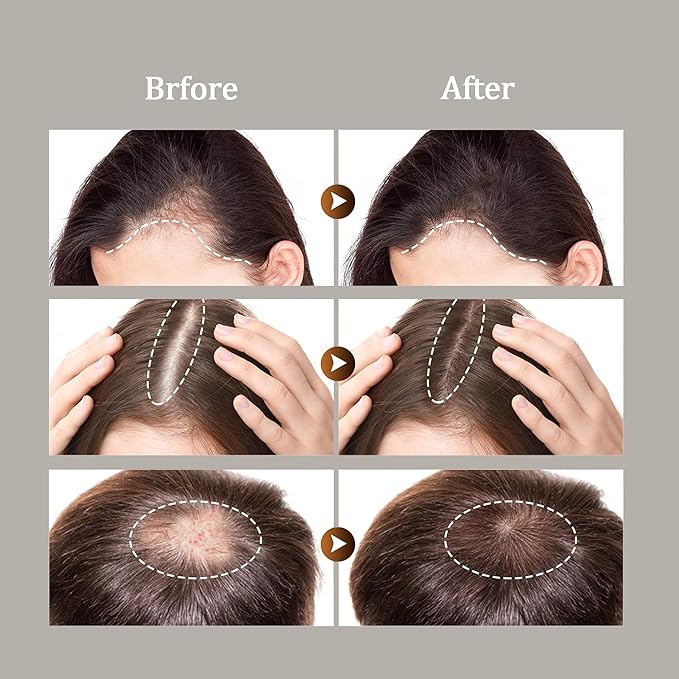 Dr.Healdy Batana Oil Conditioner for Hair Growth - Repairs Damage, Nourishes Scalp & Strengthens Hair Roots - Sulfate Free Formula for All Hair Types (6.8 Fl Oz)