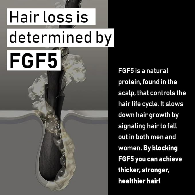 EVOLIS Reverse Scalp Activator - Hair Growth Serum - Scalp Serum & Hair Thickening Scalp Treatment for Fuller, Thicker Hair (1.7 fl oz)