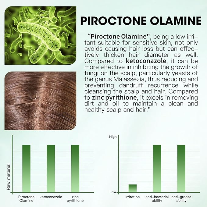 Anti Dandruff Shampoo - Scalp Deep Cleansing, Excess Sebum Care, Natural Ingredients - For Women & Men, Soothes Itchy, Dry Scalp, 16.8 fl.oz